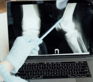 무릎에 물이 차는 증상 이유, 찼을 때 치료법과 치료기간