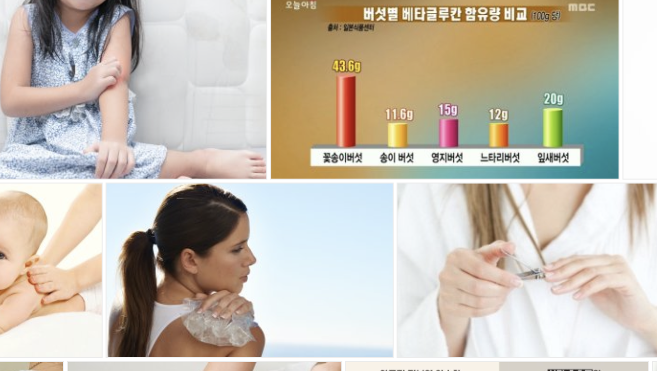아토피 가려움 증상을 완화하는 자연 요법