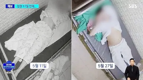국립과학수사연구원-부검