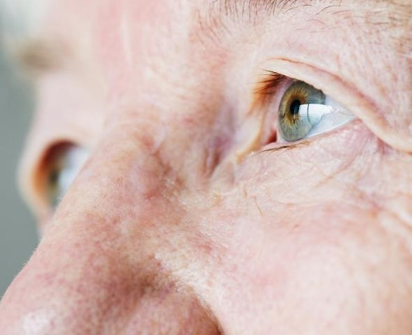 비문증 자주 묻는 질문 FAQ