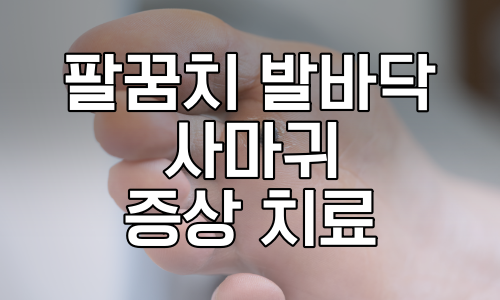 사마귀