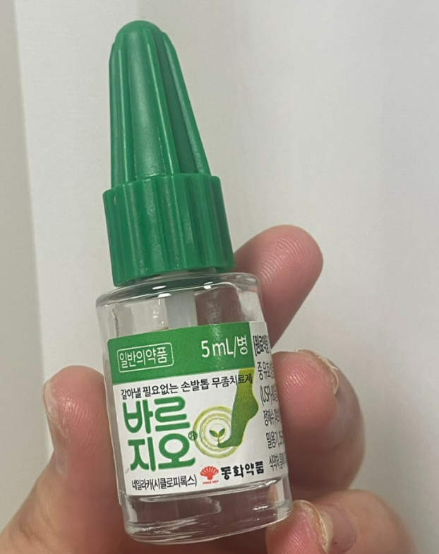 바르지오 무좀약으로 발톱 무좀 치료 기간 어느 정도 걸릴까?