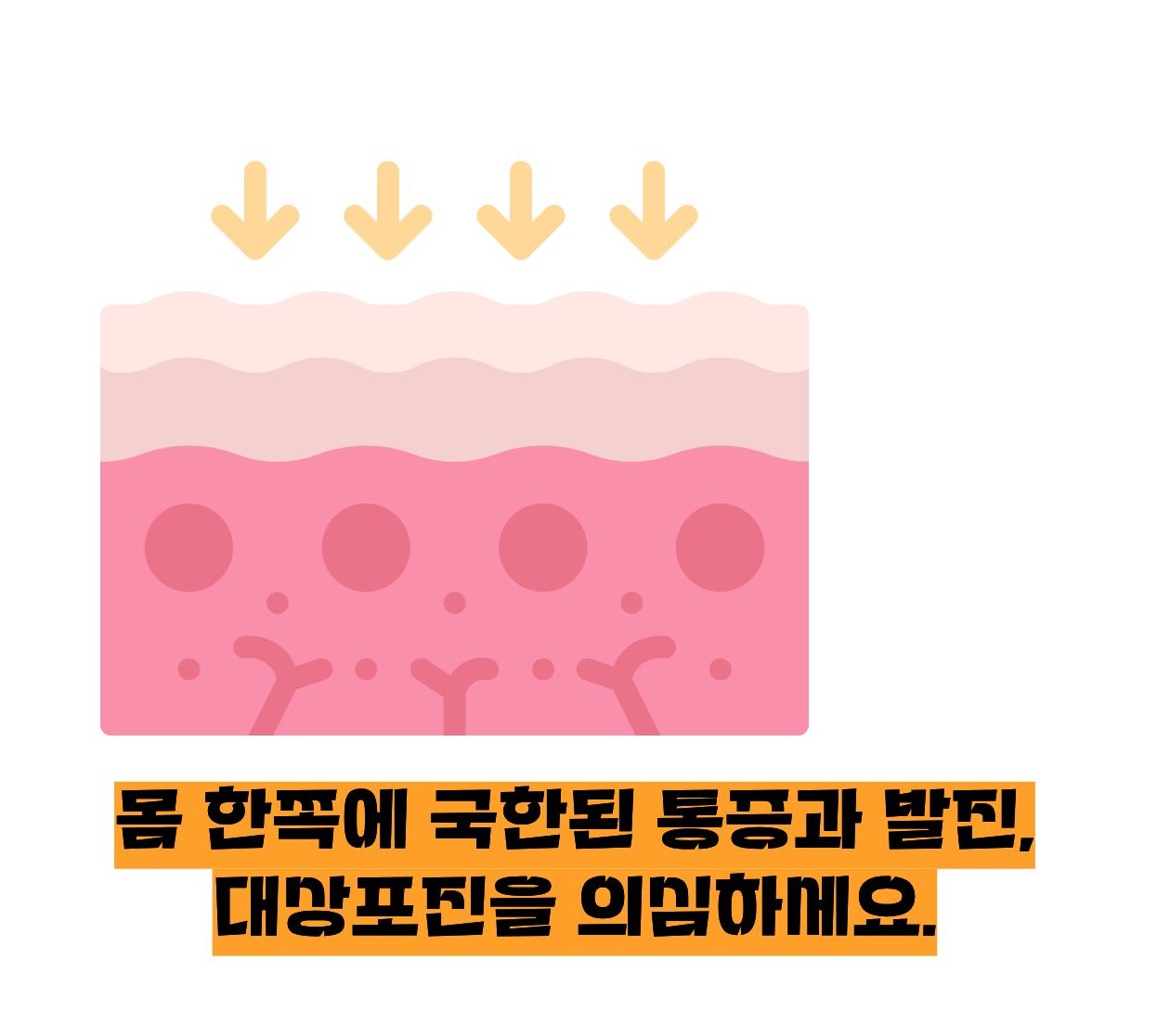 대상포진 초기증상