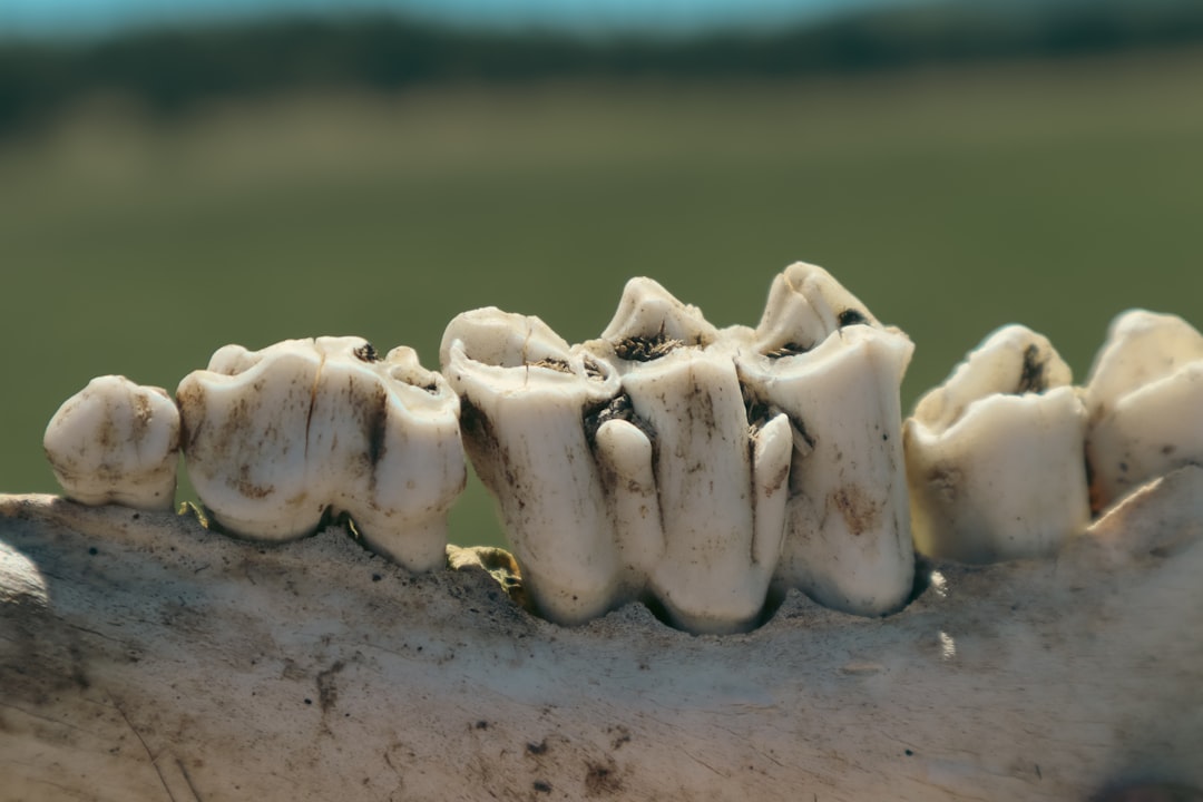 Dentures.