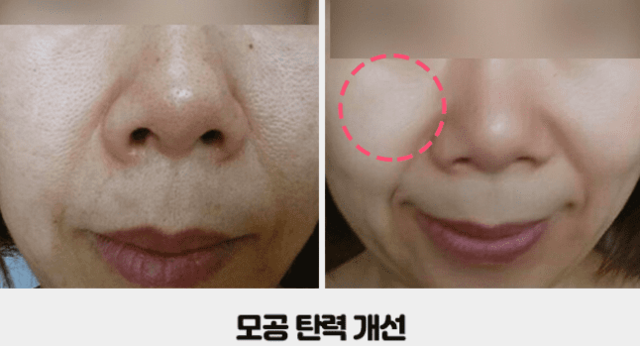 고혼진 리얼후기