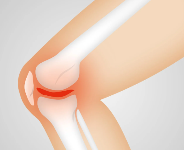 무릎통증 원인 및 치료방법