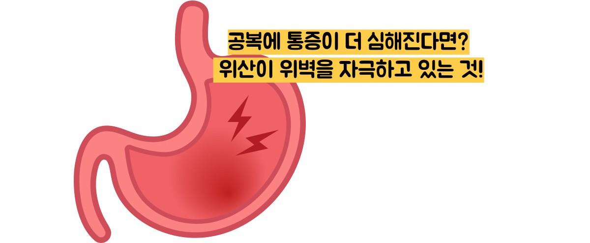 위궤양 증상