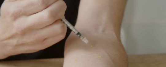 뱀에-물렸을때-응급처치