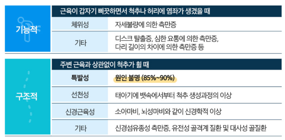 척추측만증 원인