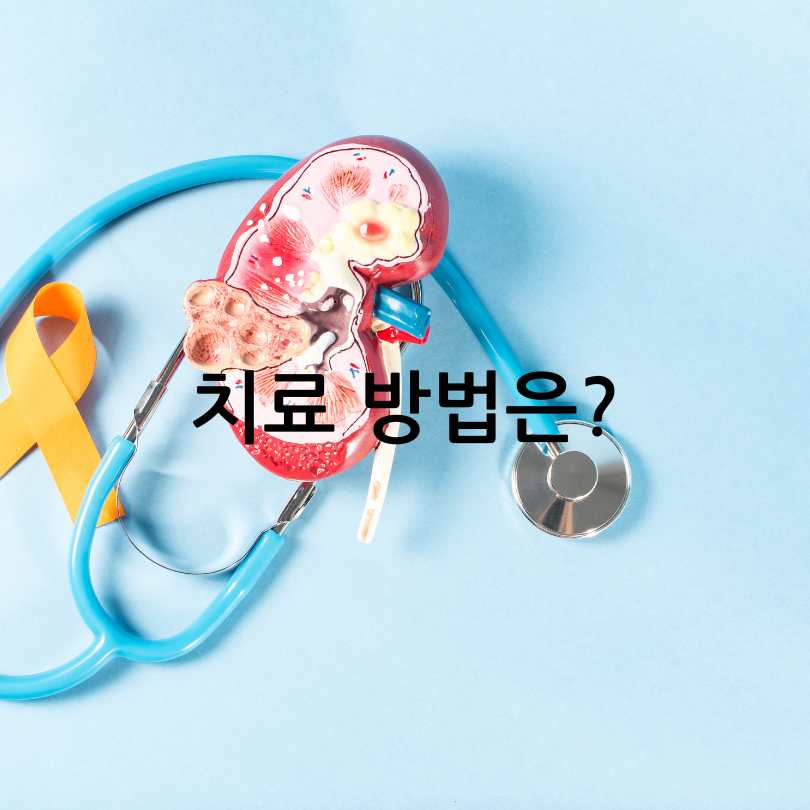 다낭성 신장증후군 증상과 치료법