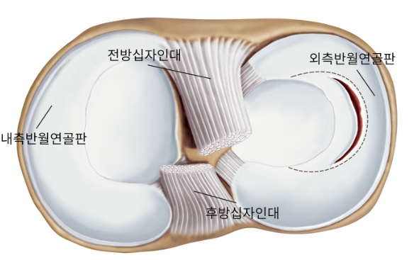 내측반월판, 외측반월판