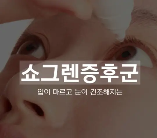 쇼그렌 증후군