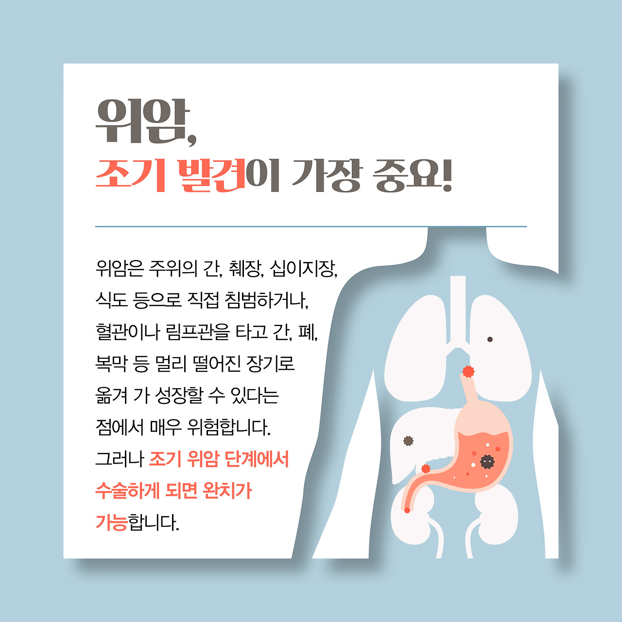 alt=&quot;위암, 조기발견이 중요&quot;