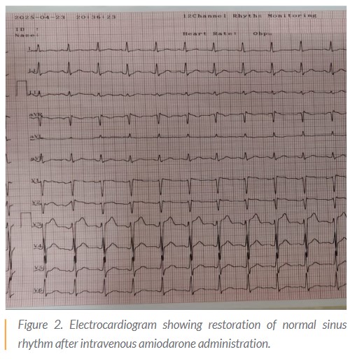 부정맥 유발 홍삼