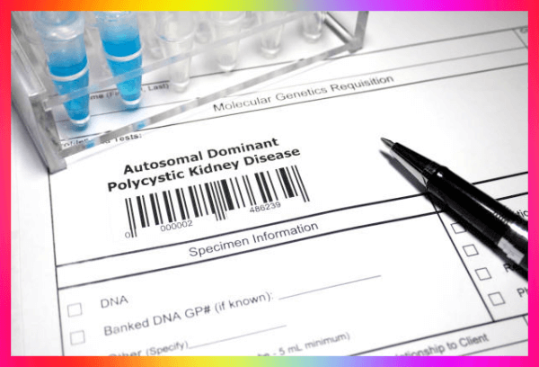 다낭성신증 신장투석질환 진단