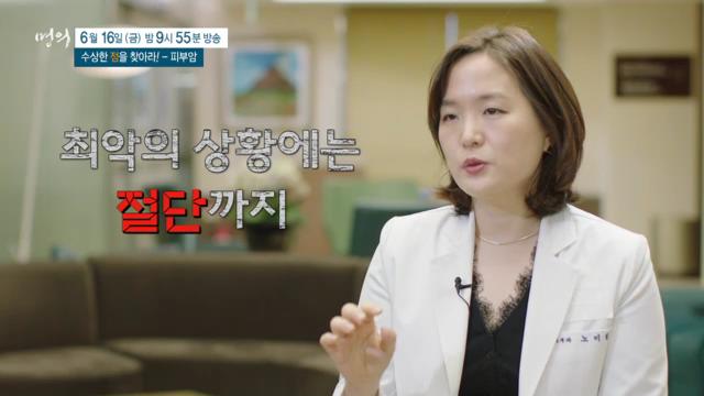 명의 수상한 '점'을 찾아라, 피부암, 악성 흑색종, 예방, 치료 방법