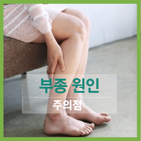 부종 원인 및 주의점