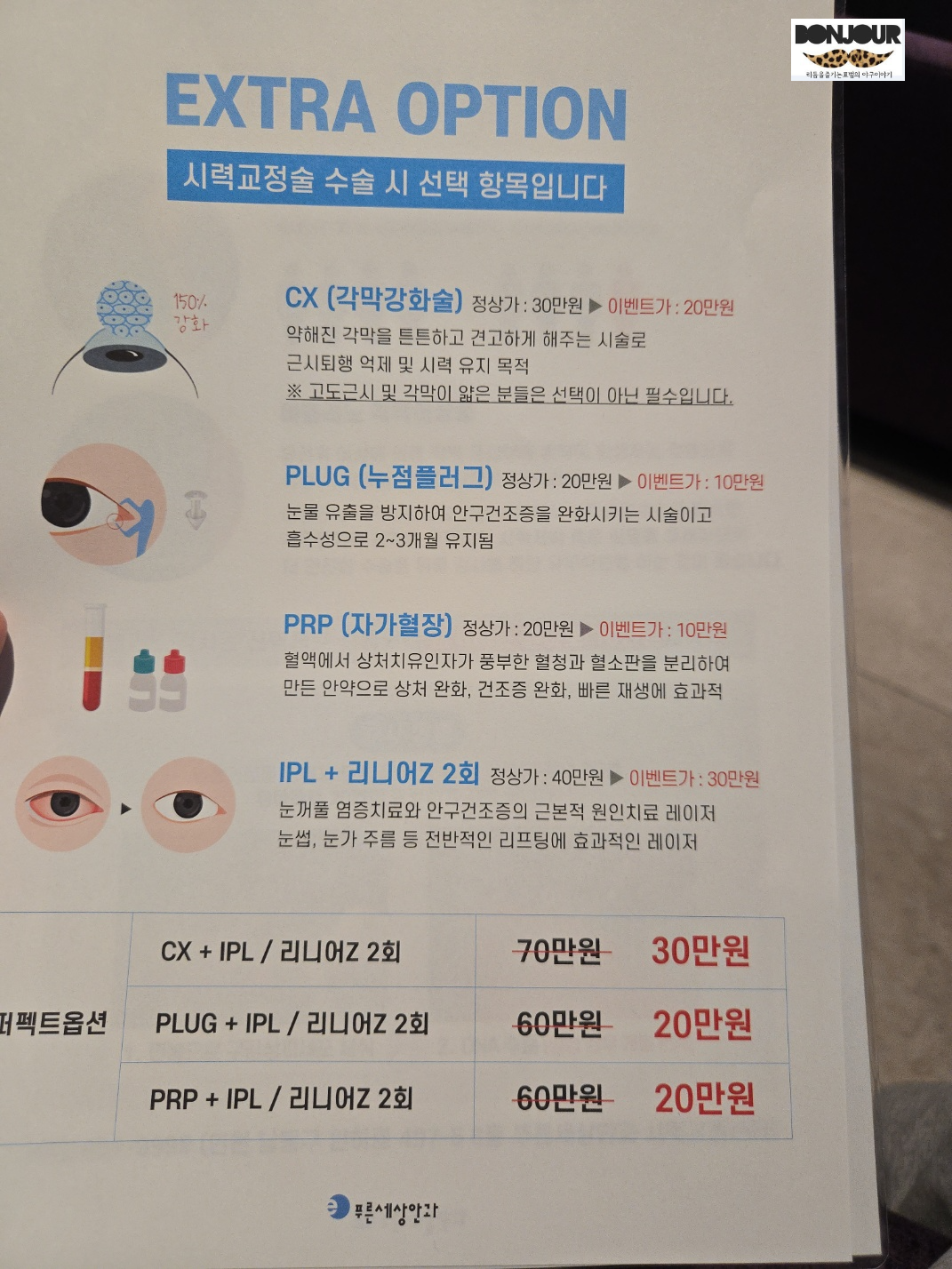 시력교정술 추가옵션 안내지