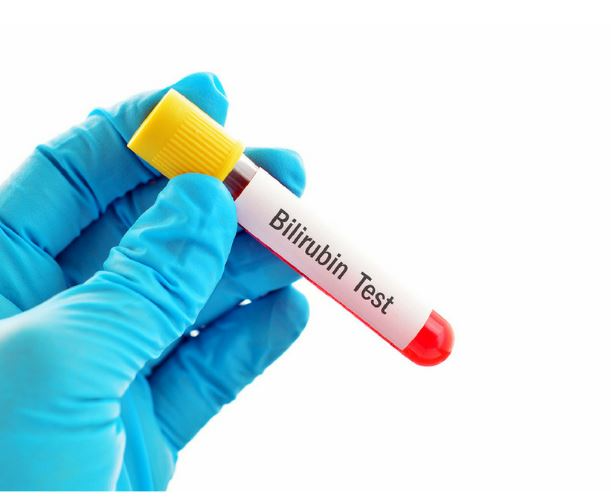 빌리루빈-정상수치