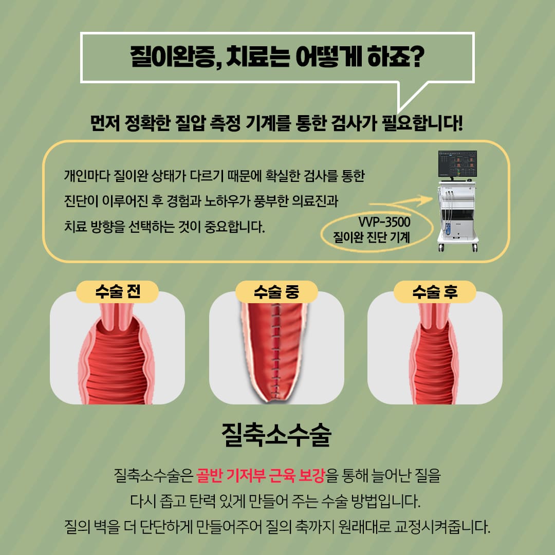 질조임 치료 어떻게 하나요?