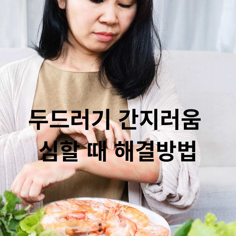 두드러기 간지러움 심할 때 해결방법과 원인