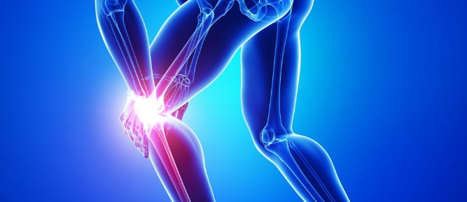 류마티스 관절염4