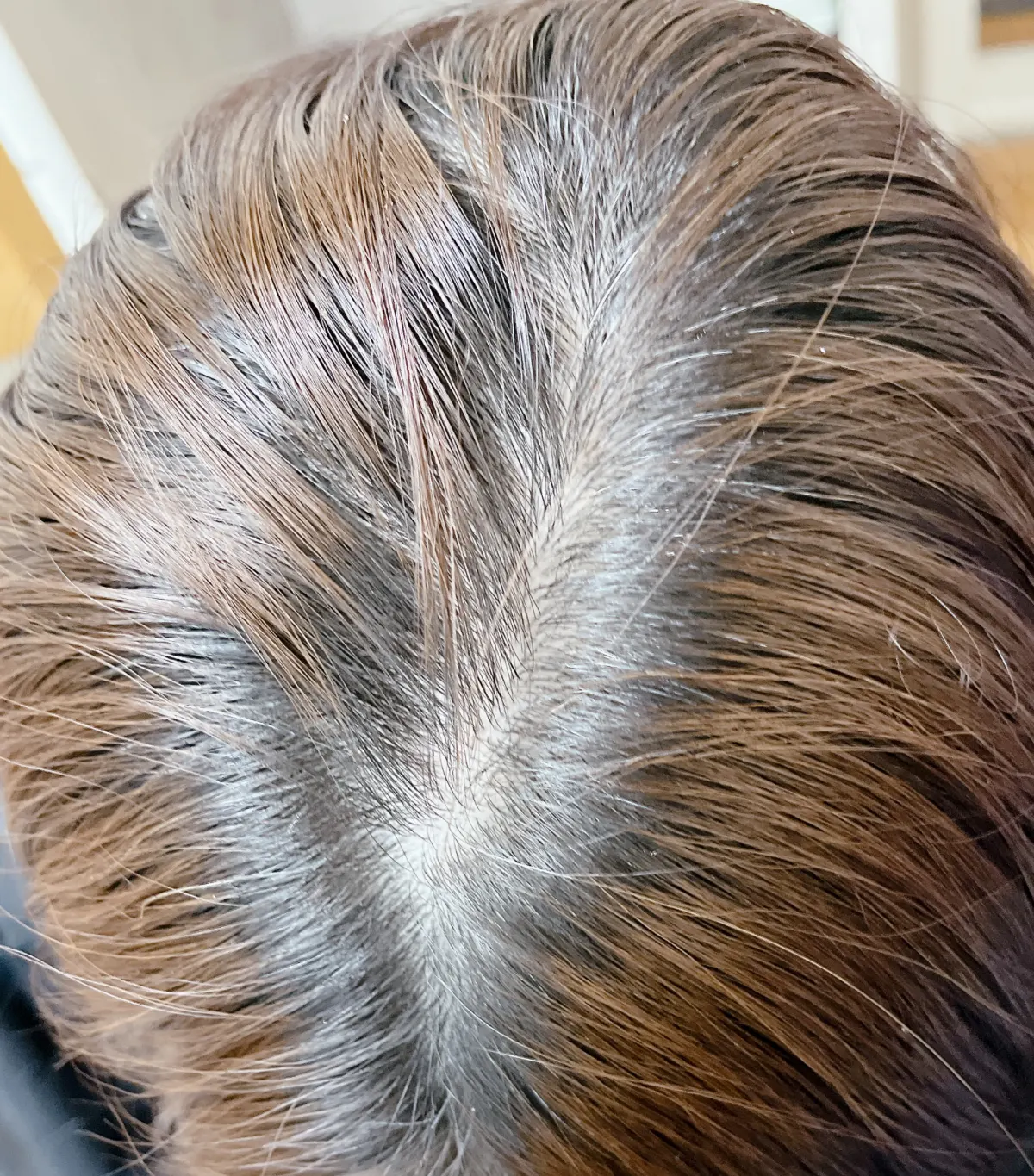 염색 전 사진-염색물이 빠져서 머리카락 색이 얼룩지고 흰 머리가 보임