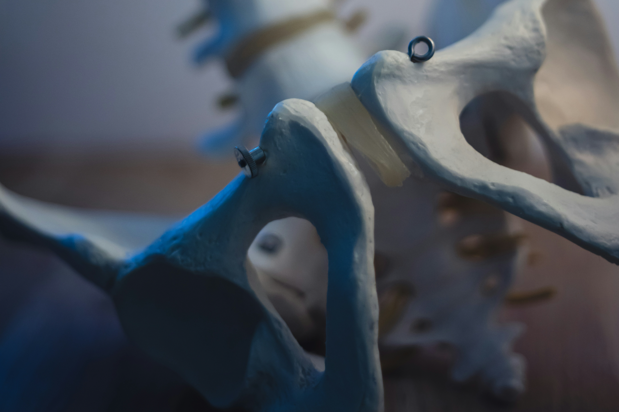 골반 뼈의 모습