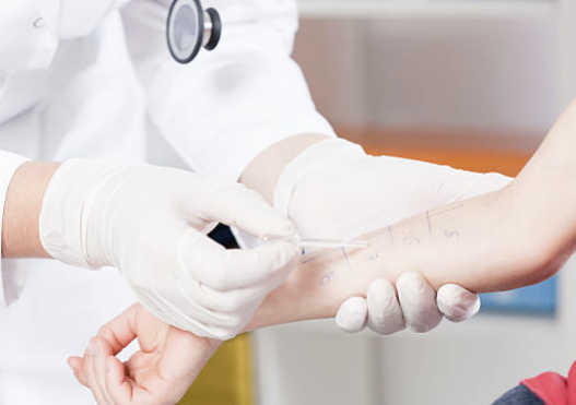 지연성 알러지 검사 증상, 원인, 검사 비용 총정리