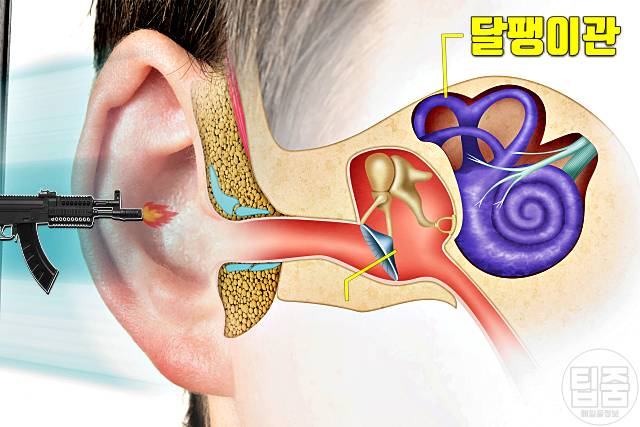 귀에서 삐소리 이명 증상 원인 달팽이관