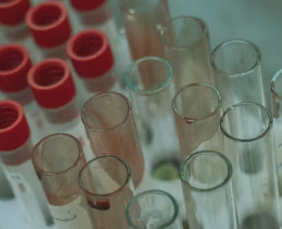 빈혈 증상 원인 치료 방법