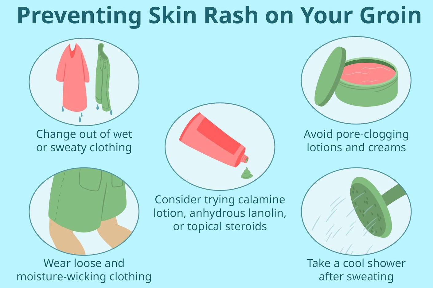 땀띠의 예방과 치료 방법