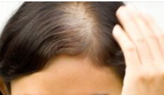 탈모-예방-방법