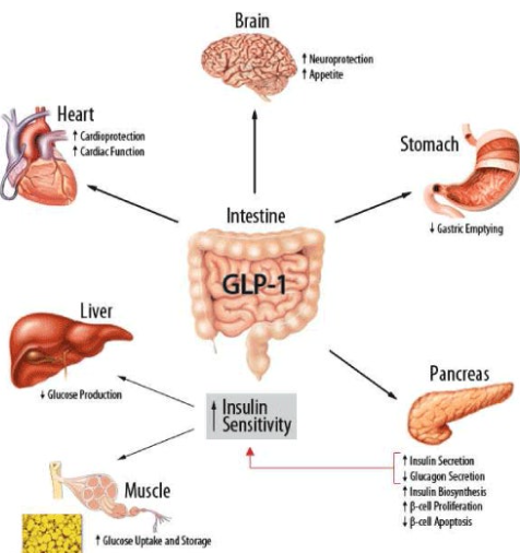 GLP-1유사체와 급성 췌장염 부작용 증가 관련 이미지