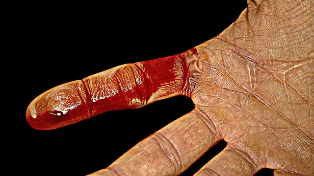 마버그 바이러스