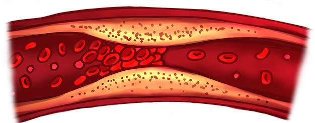 콜레스테롤 수치별 가이드 관련 이미지