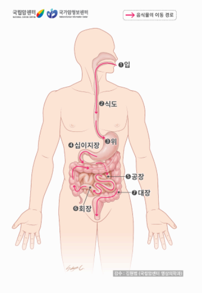 위암 초기 증상, 놓치지 말아야 할 경고 신호