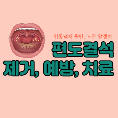 편도결석-제거-예방-치료-대표섬네일