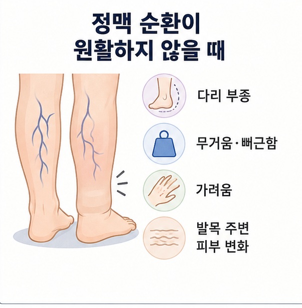 다리 부종과 무거움, 뻐근함, 가려움, 발목 주변 피부 변화 등 정맥 순환 문제에서 나타날 수 있는 증상을 표현한 이미지