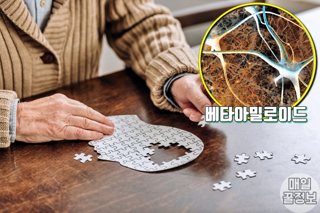혈액형별 잘 걸리는 병 질환, ab형 치매