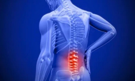 요추 염좌 증상 4가지