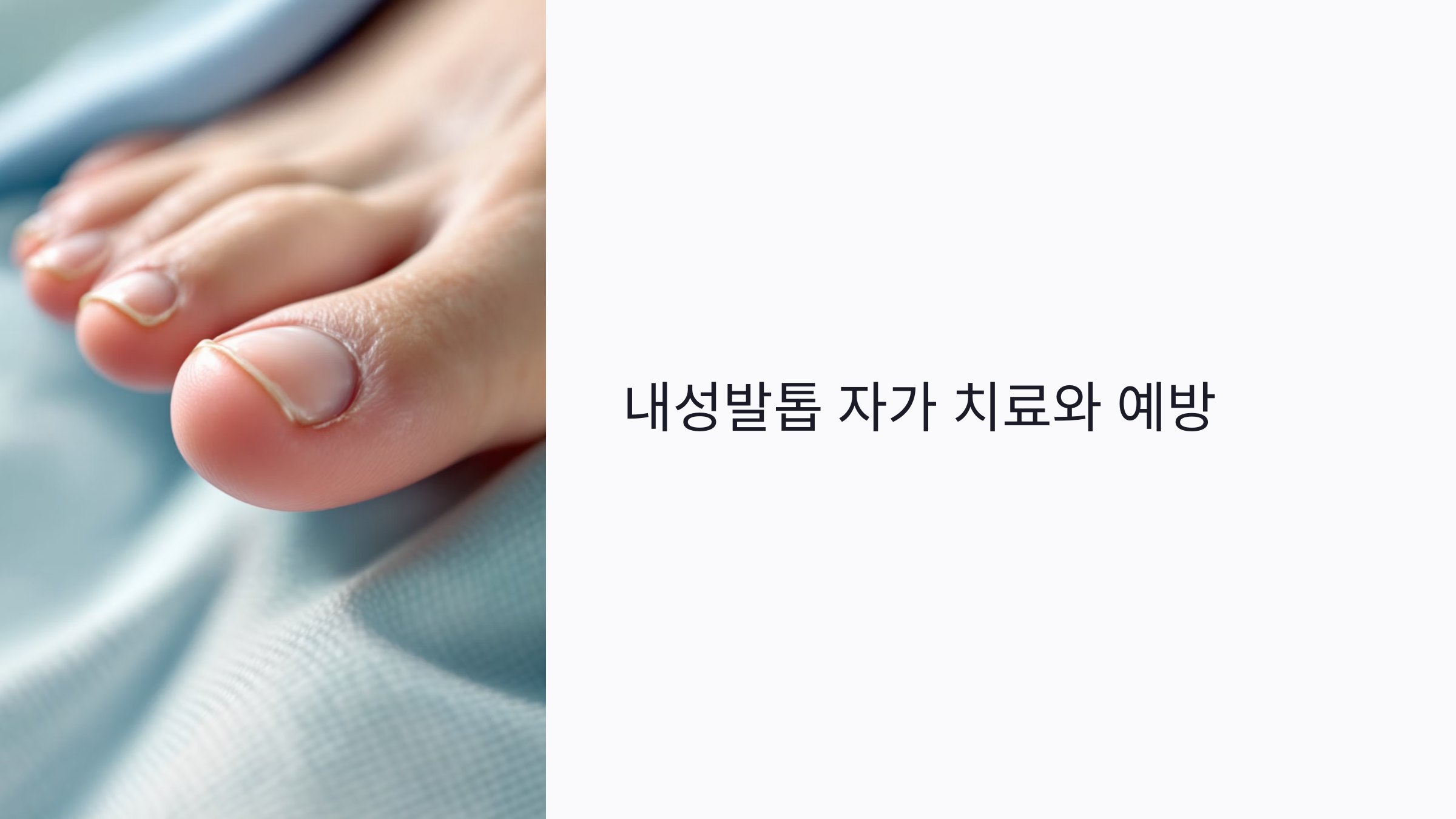 발톱 자르다 내성발톱 생겼다면? 자가 치료법부터 병원 가야 할 상황까지 총정리