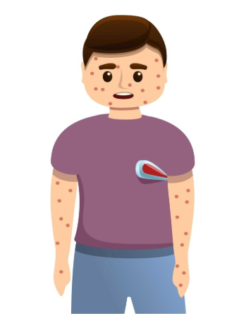 돌발진과 비슷한 증상을 가진 다른 질환들