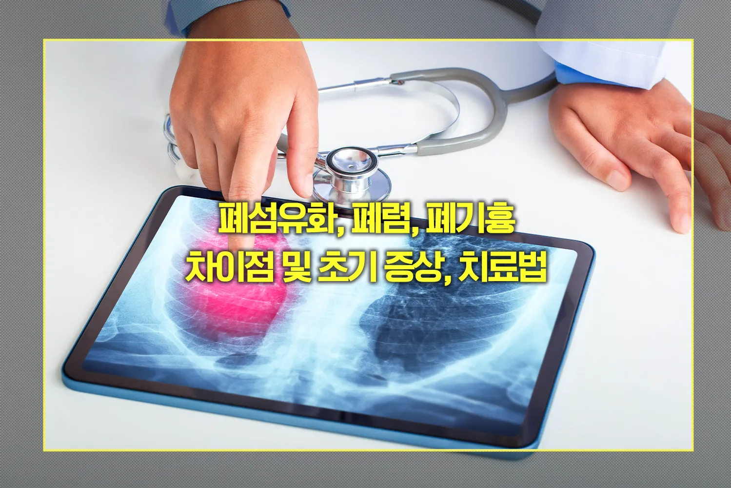 폐섬유화, 폐렴, 폐기흉 초기 증상, 치료법