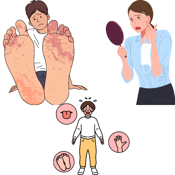 수족구증상 성인