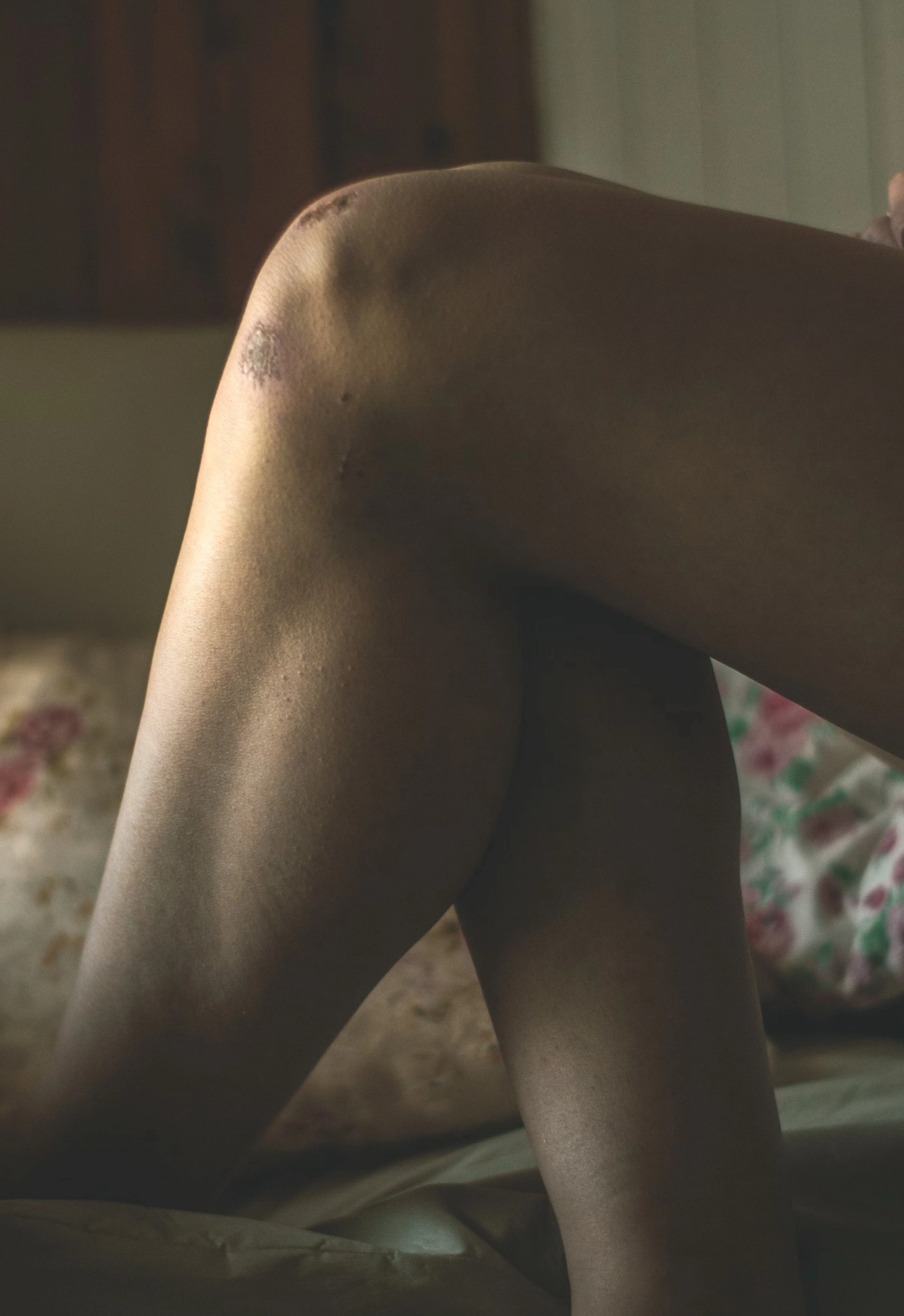 무릎연골에 좋은 영양제