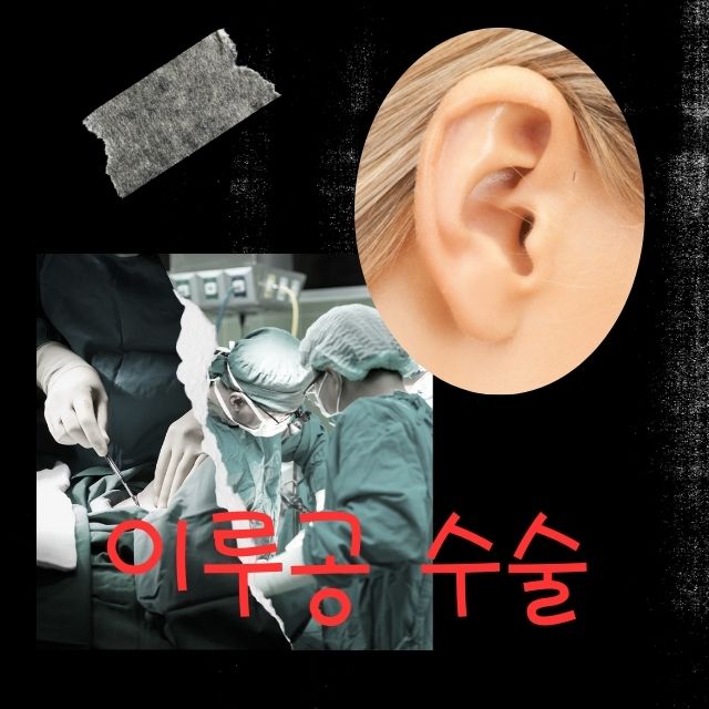이루공수술