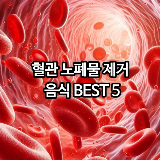 혈관 노폐물 제거 음식 BEST 5