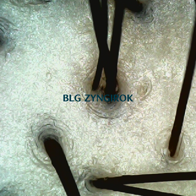 탈모 극복 프로젝트 - 정수리 두피 모습이다.