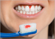 잇치 치약 가격, 파는곳, 효과, 성분